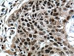 ZNF750 Antibody in Immunohistochemistry (Paraffin) (IHC (P))