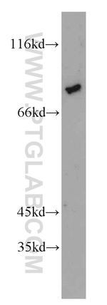 ZNF750 Antibody in Western Blot (WB)