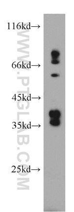 RASSF7 Antibody in Western Blot (WB)