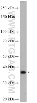 RASSF7 Antibody in Western Blot (WB)