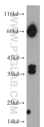 RASSF7 Antibody in Western Blot (WB)