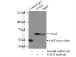 GAD65 Antibody in Immunoprecipitation (IP)