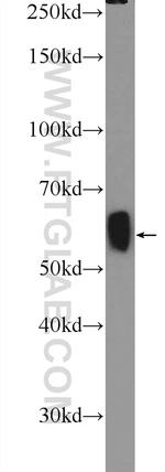 GAD65 Antibody in Western Blot (WB)