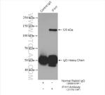 IFIH1 Antibody in Immunoprecipitation (IP)