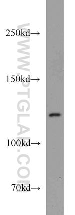 IFIH1 Antibody in Western Blot (WB)