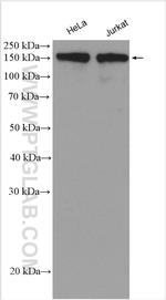 Ataxin 2 Antibody in Western Blot (WB)