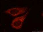 Ataxin 2 Antibody in Immunocytochemistry (ICC/IF)