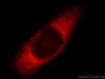 Ataxin 2 Antibody in Immunocytochemistry (ICC/IF)