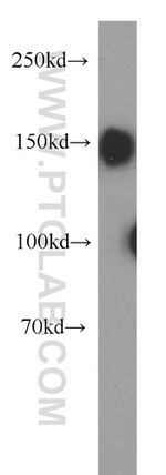 Ataxin 2 Antibody in Western Blot (WB)