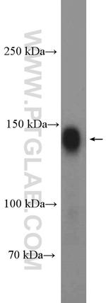 Ataxin 2 Antibody in Western Blot (WB)