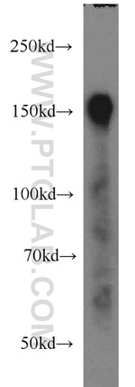 Ataxin 2 Antibody in Western Blot (WB)