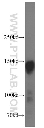 Ataxin 2 Antibody in Western Blot (WB)