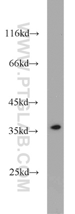 TTF1/NKX2-1 Antibody in Western Blot (WB)