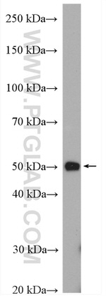 TTF1/NKX2-1 Antibody in Western Blot (WB)