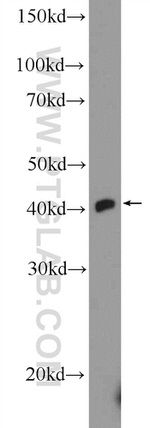 TTF1/NKX2-1 Antibody in Western Blot (WB)