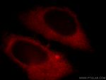 LDHA Antibody in Immunocytochemistry (ICC/IF)