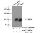 EZH2 Antibody in Immunoprecipitation (IP)