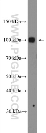 EZH2 Antibody in Western Blot (WB)