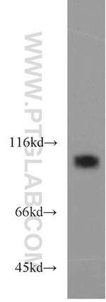 EZH2 Antibody in Western Blot (WB)