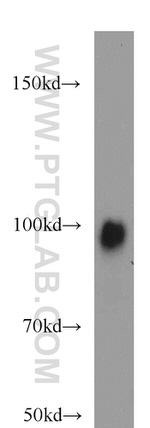 EZH2 Antibody in Western Blot (WB)