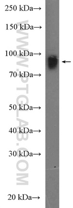 EZH2 Antibody in Western Blot (WB)