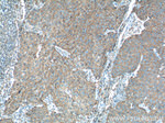 GLUT1 Antibody in Immunohistochemistry (Paraffin) (IHC (P))