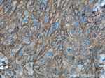 GLUT1 Antibody in Immunohistochemistry (Paraffin) (IHC (P))