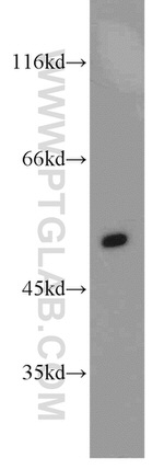 GLUT1 Antibody in Western Blot (WB)