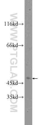 MASP1 Antibody in Western Blot (WB)