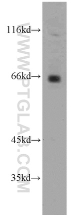 ZNF74 Antibody in Western Blot (WB)