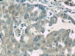 ROCK1 Antibody in Immunohistochemistry (Paraffin) (IHC (P))