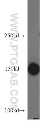 ROCK1 Antibody in Western Blot (WB)