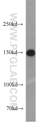 ROCK1 Antibody in Western Blot (WB)