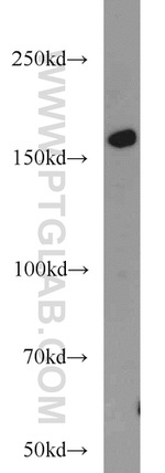 ROCK1 Antibody in Western Blot (WB)