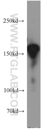 ROCK1 Antibody in Western Blot (WB)