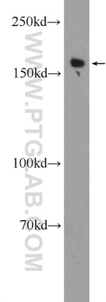 ROCK1 Antibody in Western Blot (WB)