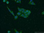 SOAT2 Antibody in Immunocytochemistry (ICC/IF)