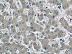 SOAT2 Antibody in Immunohistochemistry (Paraffin) (IHC (P))