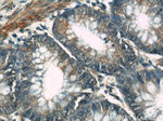 NR3C2 Antibody in Immunohistochemistry (Paraffin) (IHC (P))