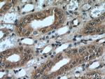 NR3C2 Antibody in Immunohistochemistry (Paraffin) (IHC (P))