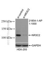 NR3C2 Antibody in Western Blot (WB)