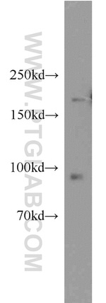 NR3C2 Antibody in Western Blot (WB)