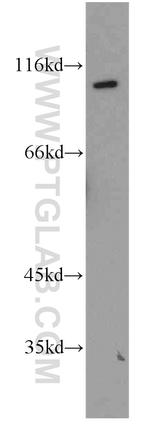 NR3C2 Antibody in Western Blot (WB)