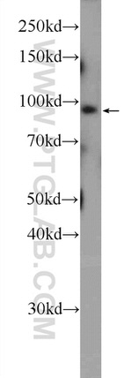 NR3C2 Antibody in Western Blot (WB)