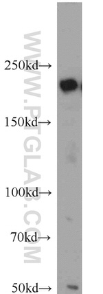 KIDINS220 Antibody in Western Blot (WB)