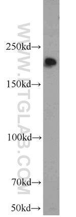 KIDINS220 Antibody in Western Blot (WB)