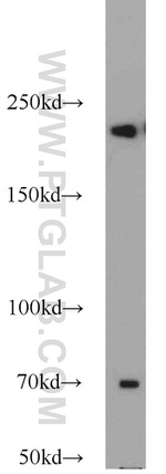 KIDINS220 Antibody in Western Blot (WB)