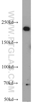 KIDINS220 Antibody in Western Blot (WB)