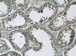 SAFB Antibody in Immunohistochemistry (Paraffin) (IHC (P))