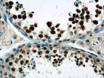 SAFB Antibody in Immunohistochemistry (Paraffin) (IHC (P))